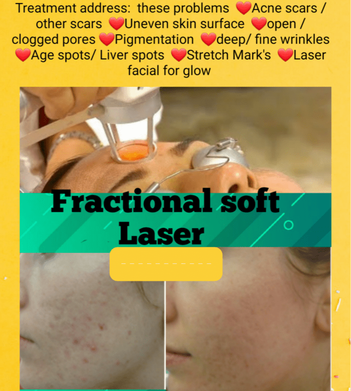 CO2 Laser Skin Resurfacing Glasgow